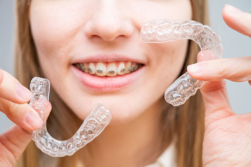 Woman with braces, holding onto clear aligners